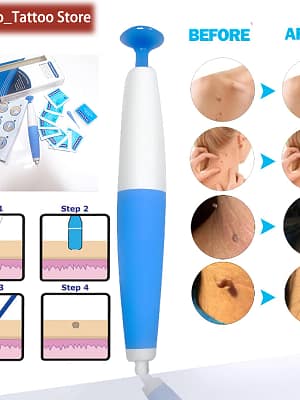 Auto Band Skin Tag Remover Kits Face Skin Care Beauty Tools Wart Remove Acne Pimple Blemish Treatments With 10pcs Rubber